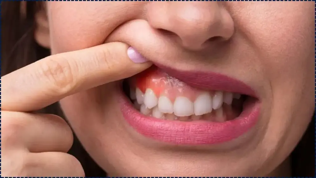 It’s Official: Nearly Half of Americans Have Gum Disease, and Their Toothbrush Habits Are to Blame 1 Half of Americans Have Gum Disease