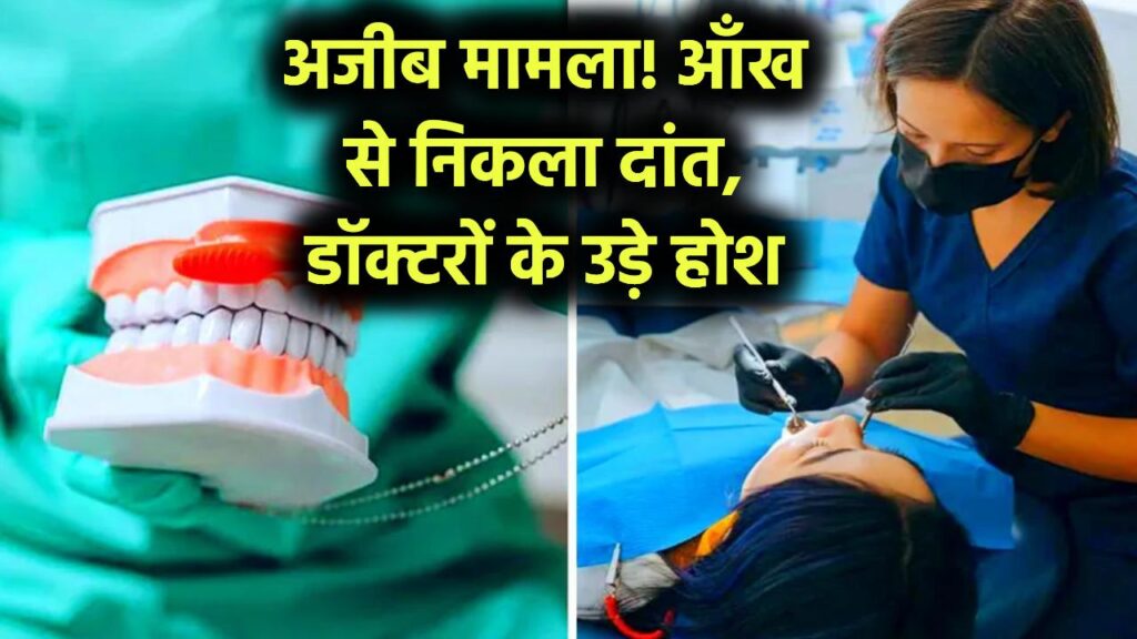 दुनिया का दुर्लभ मामला, इस शख्स की आंख में निकला दांत, डॉक्टरों के उड़ गए होश 1 दुनिया का दुर्लभ मामला, इस शख्स की आंख में निकला दांत, डॉक्टरों के उड़ गए होश
